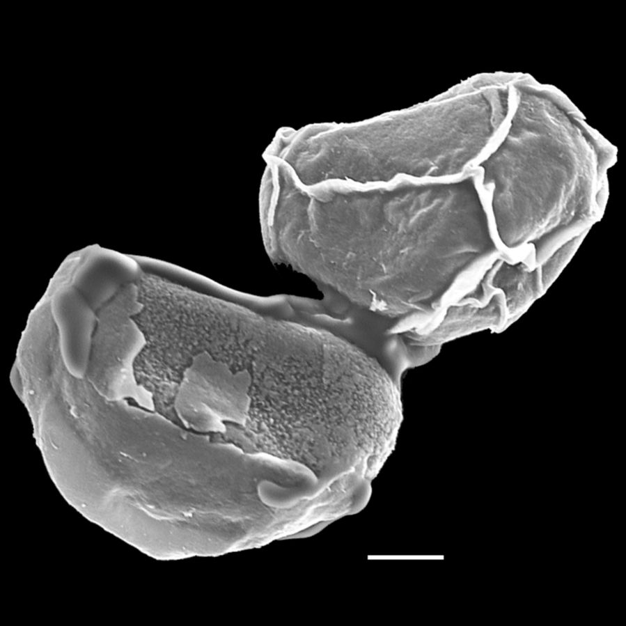 Athyriaceae Diplazium obscurum