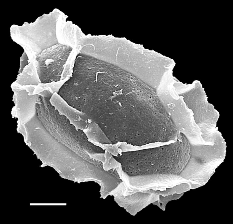 Athyriaceae Diplazium striatum