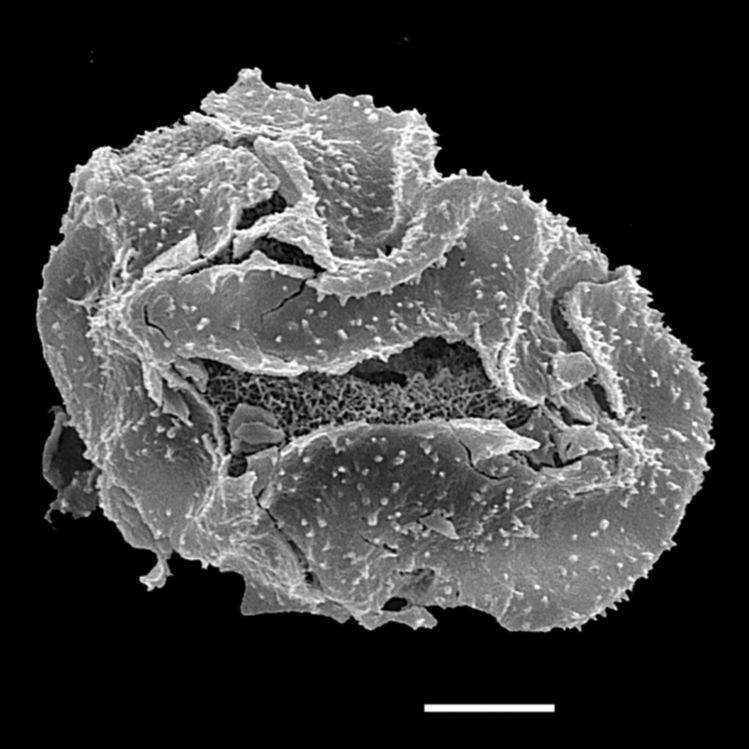 Athyriaceae Athyrium nakanoi