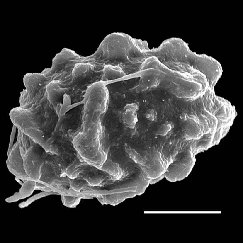 Dryopteridaceae Lastreopsis poecilophlebia
