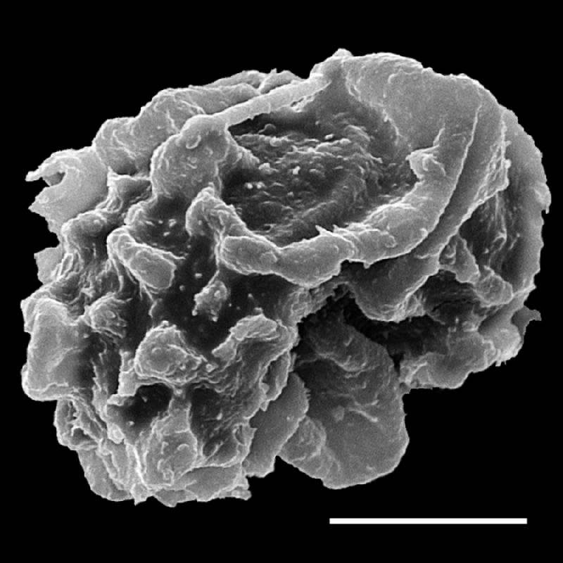 Dryopteridaceae Lastreopsis poecilophlebia