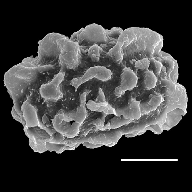 Dryopteridaceae Lastreopsis poecilophlebia