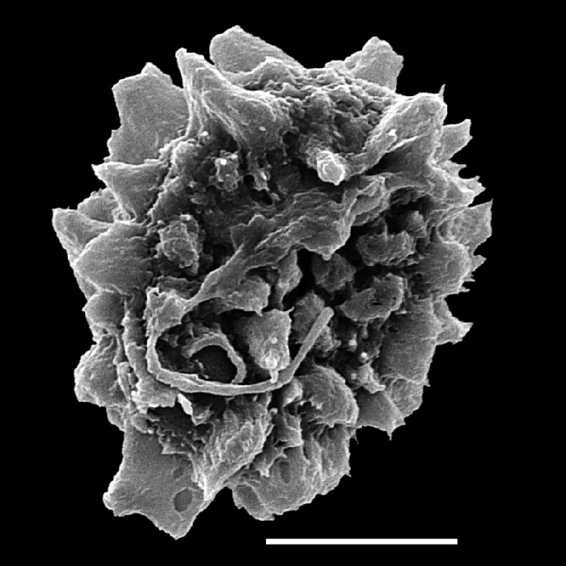 Dryopteridaceae Lastreopsis decomposita