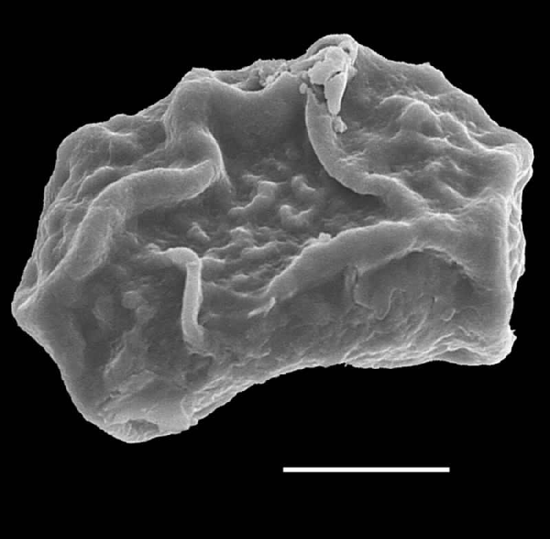 Dryopteridaceae Rumohra linearisquamata