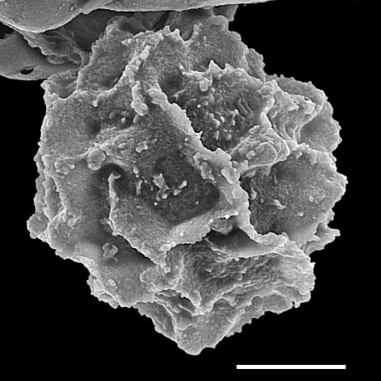 Athyriaceae Ephemeropteris tejeroi