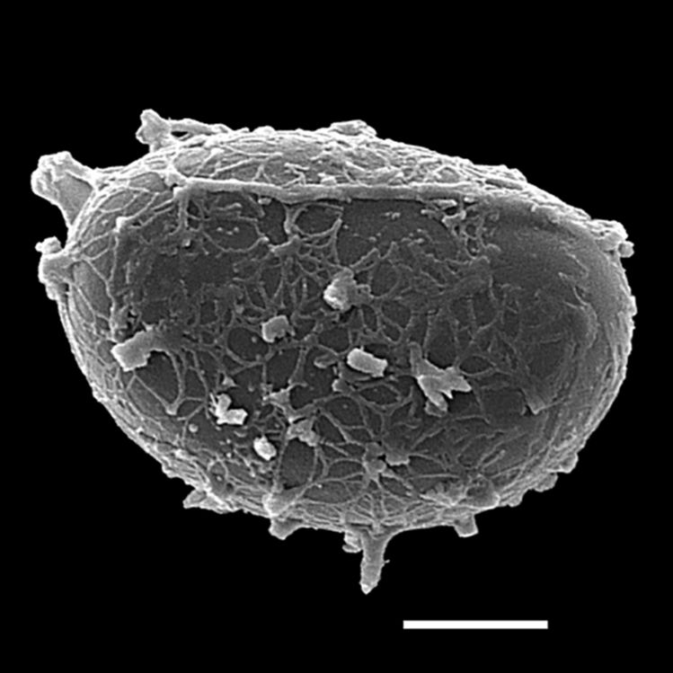Athyriaceae Deparia prolifera