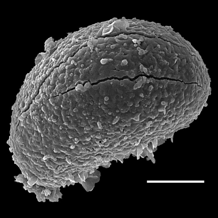 Athyriaceae Athyrium dombeyi
