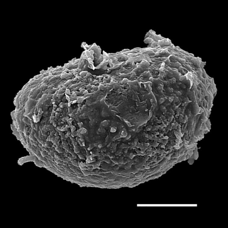 Athyriaceae Athyrium dombeyi