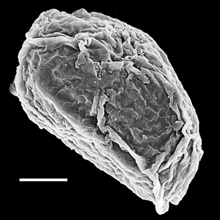 Blechnaceae Lomaria spannagelii