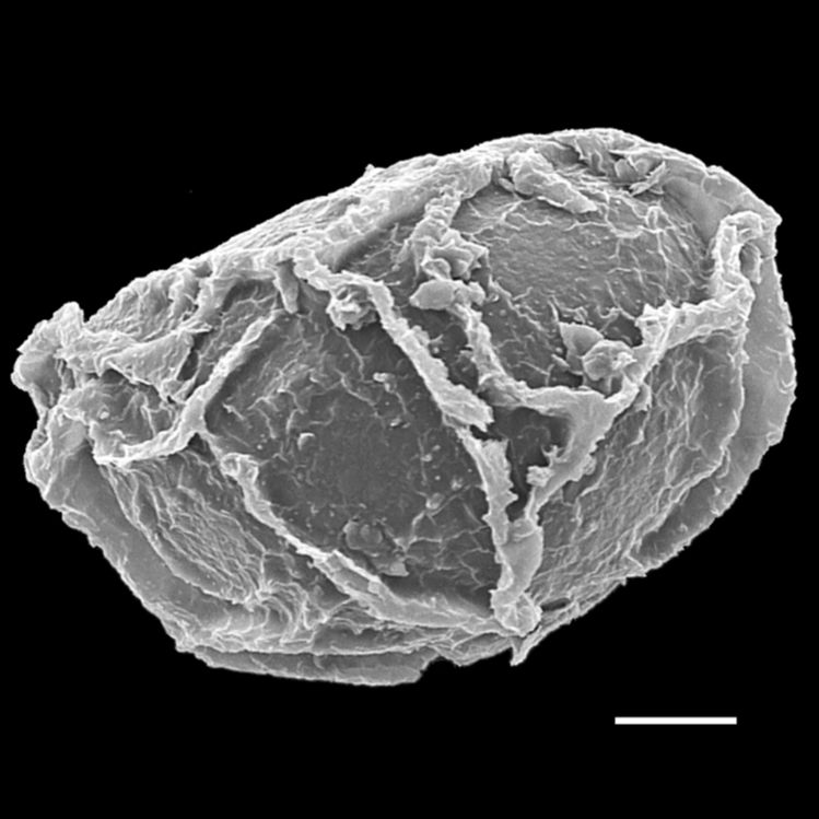 Blechnaceae Woodwardia martinezii