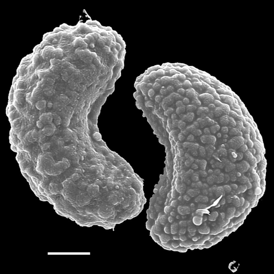 Dennstaedtiaceae Histiopteris incisa