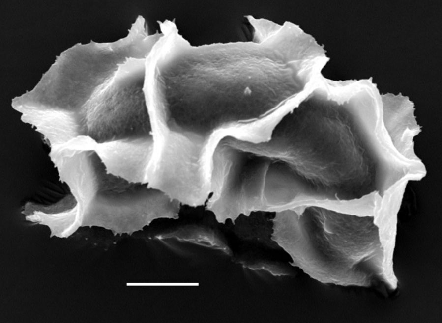 Athyriaceae Diplazium melanosorum