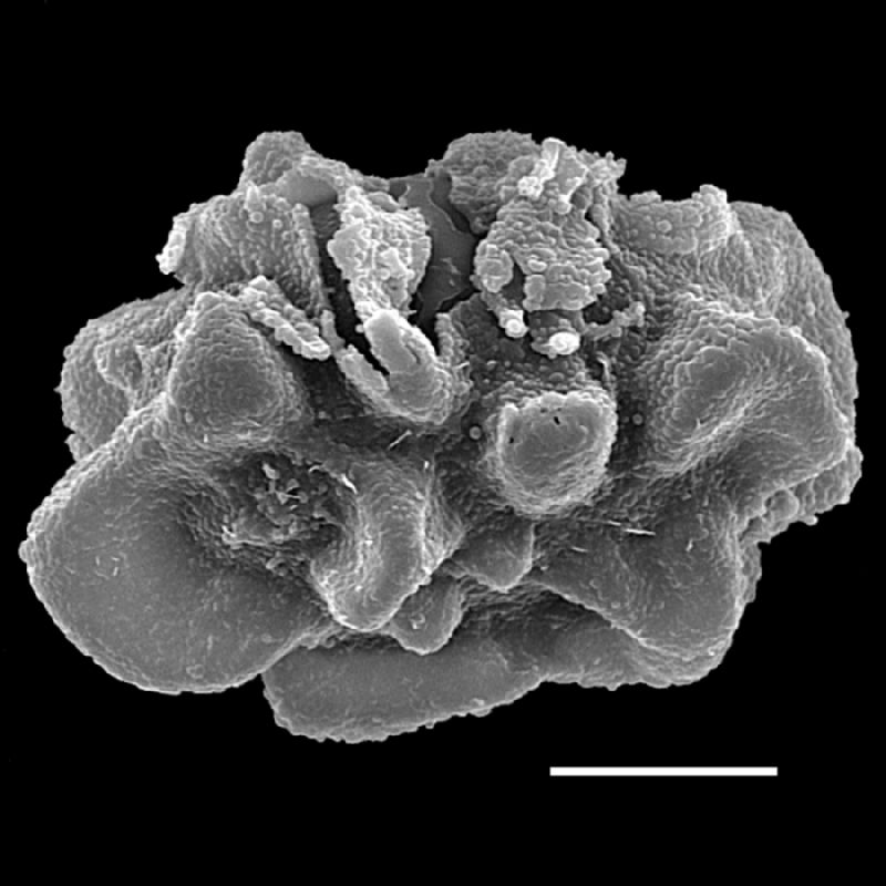 Dryopteridaceae Lastreopsis sp nov