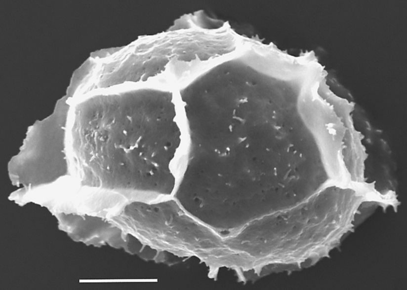 Athyriaceae Diplazium bombonasae