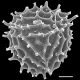 image of Anemia nervosa