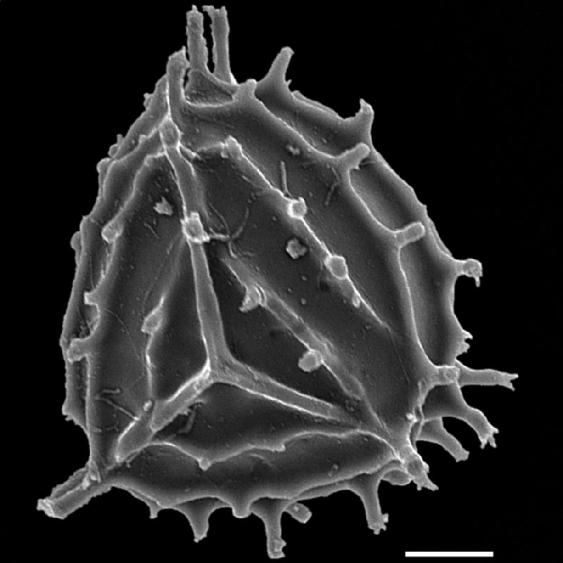 Anemiaceae Anemia nervosa