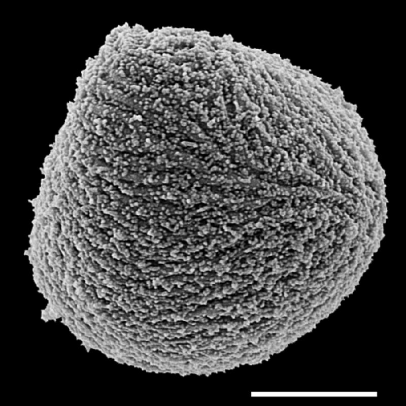 Saccolomataceae Saccoloma elegans