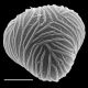 image of Saccoloma inaequale