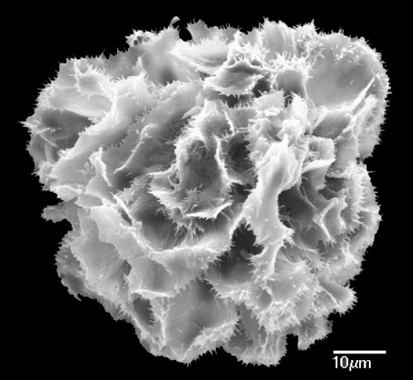 Athyriaceae Diplazium buchtienii
