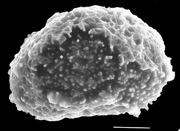 Athyriaceae Diplazium striatastrum
