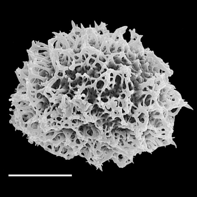 Dryopteridaceae Elaphoglossum 