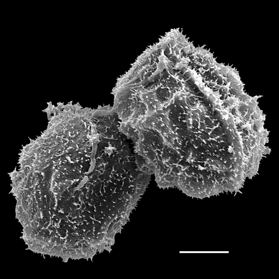 Dryopteridaceae Elaphoglossum 