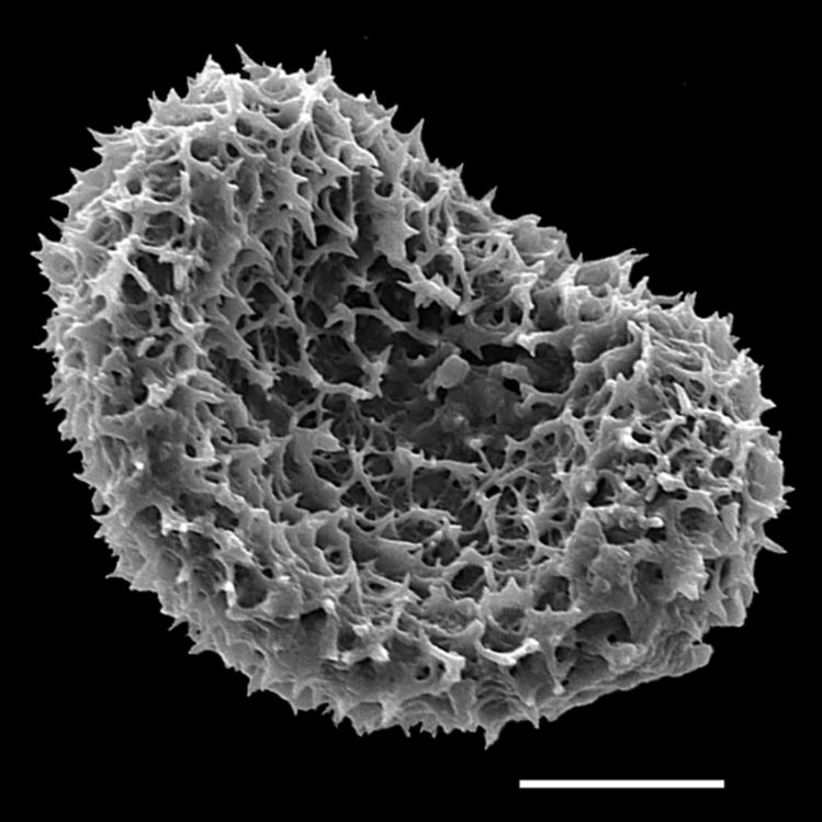 Dryopteridaceae Elaphoglossum anoriense