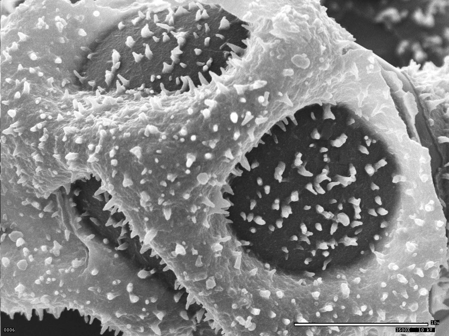Dryopteridaceae Elaphoglossum blepharis