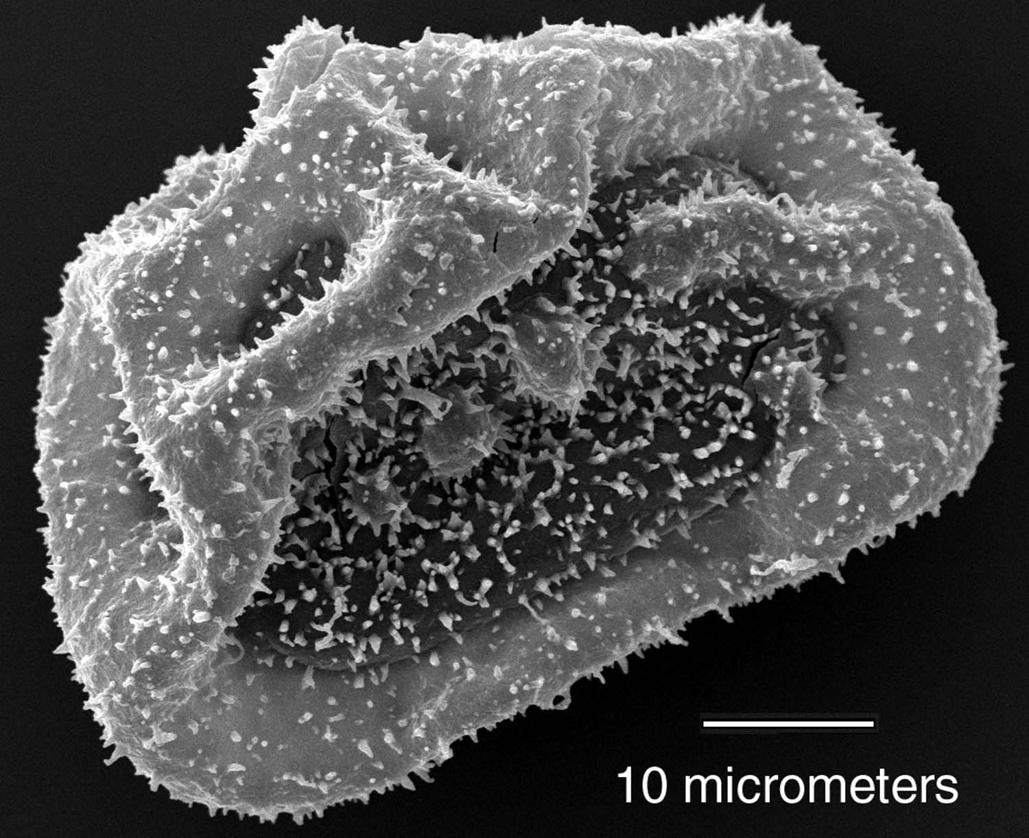 Dryopteridaceae Elaphoglossum blepharis