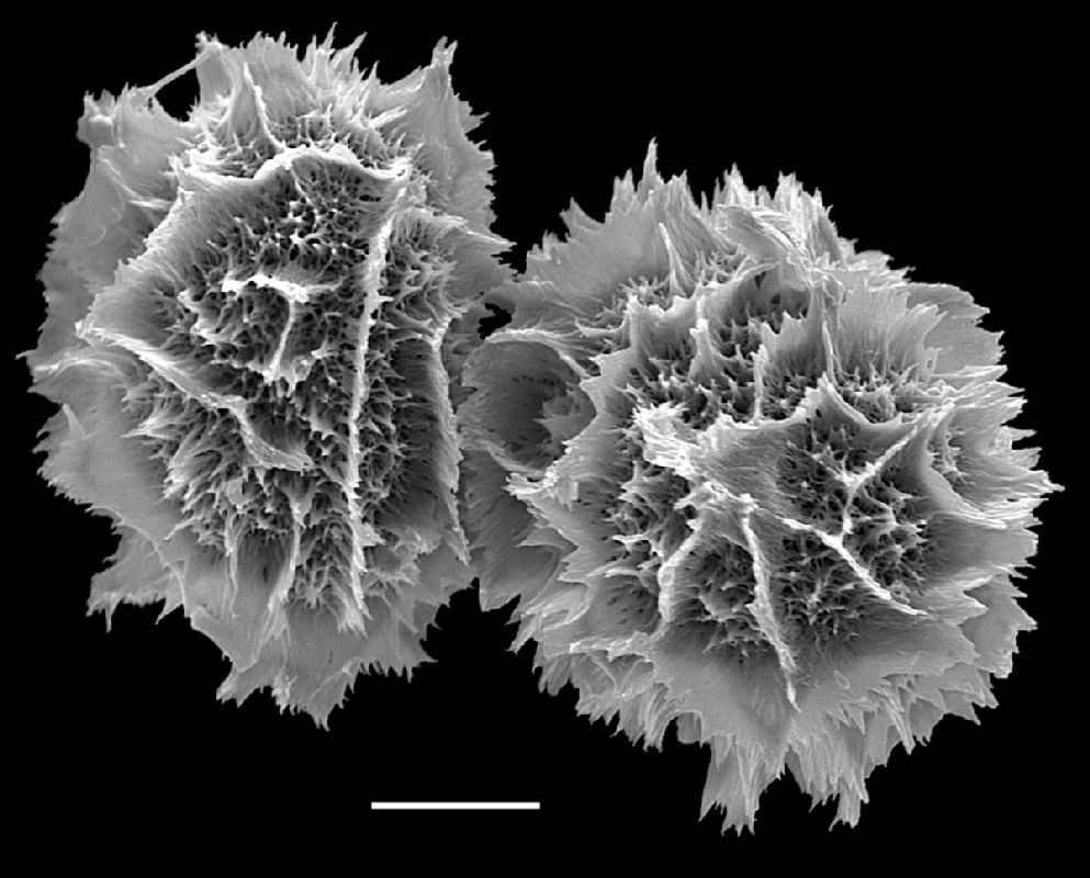 Tectariaceae Hypoderris brauniana