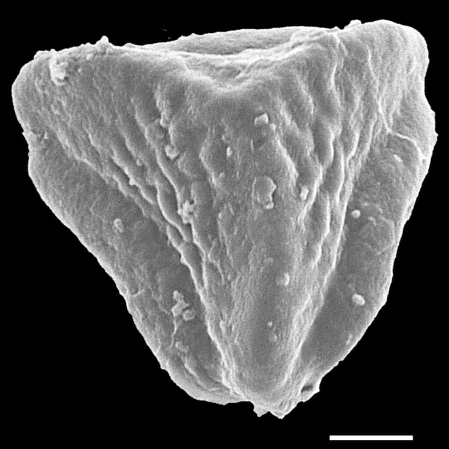 Pteridaceae Pterozonium paraphysatum