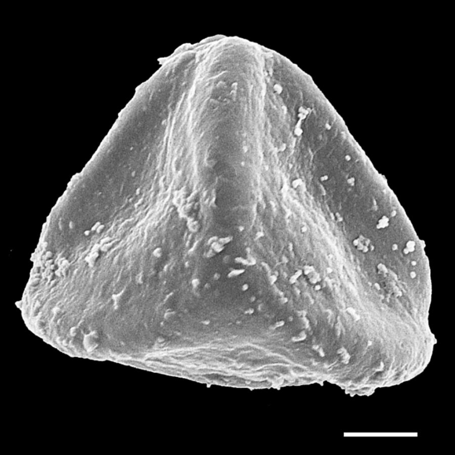Pteridaceae Pterozonium paraphysatum