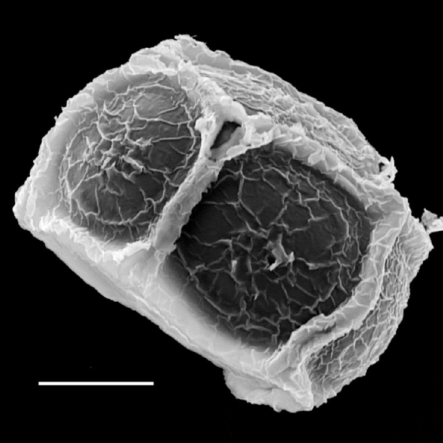 Dryopteridaceae Stigmatopteris longicaudata
