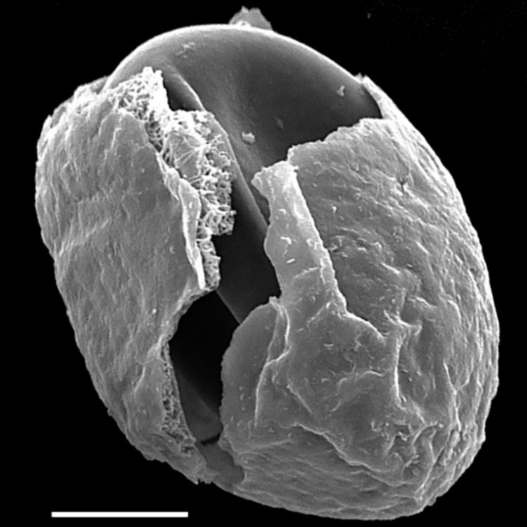 Blechnaceae Austroblechnum pattersonii