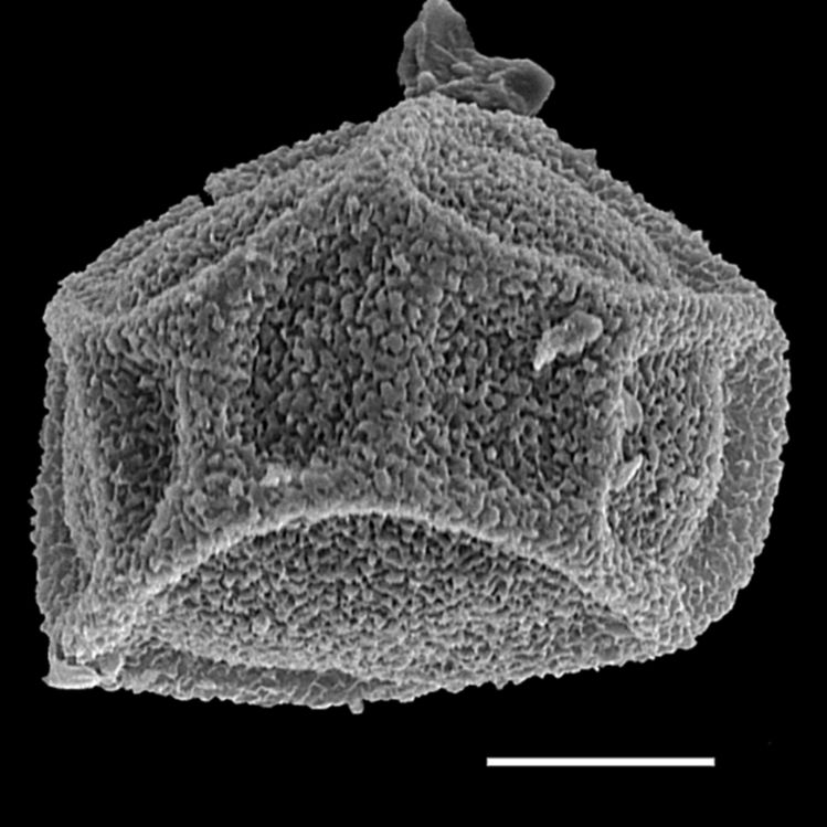 Onocleaceae Matteuccia struthiopteris