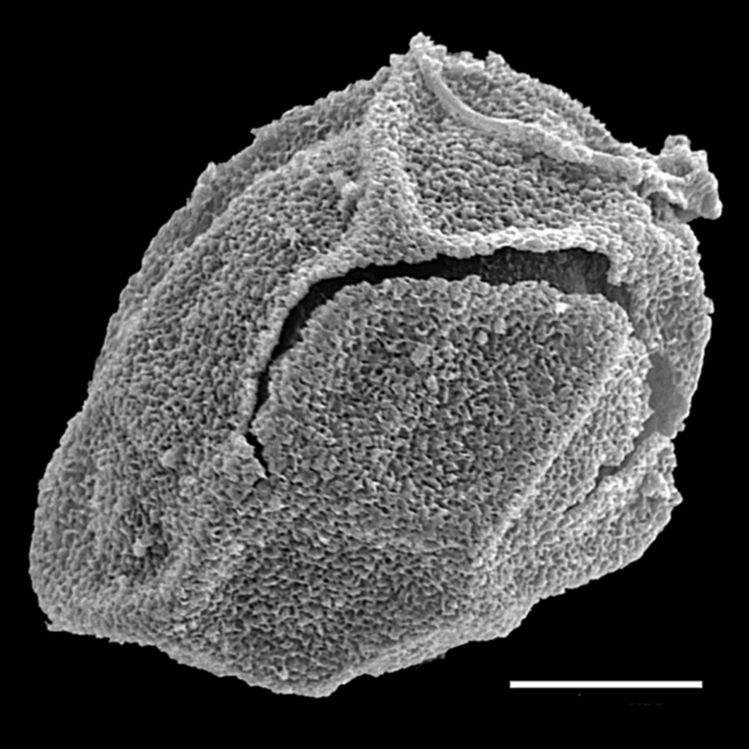 Onocleaceae Matteuccia struthiopteris