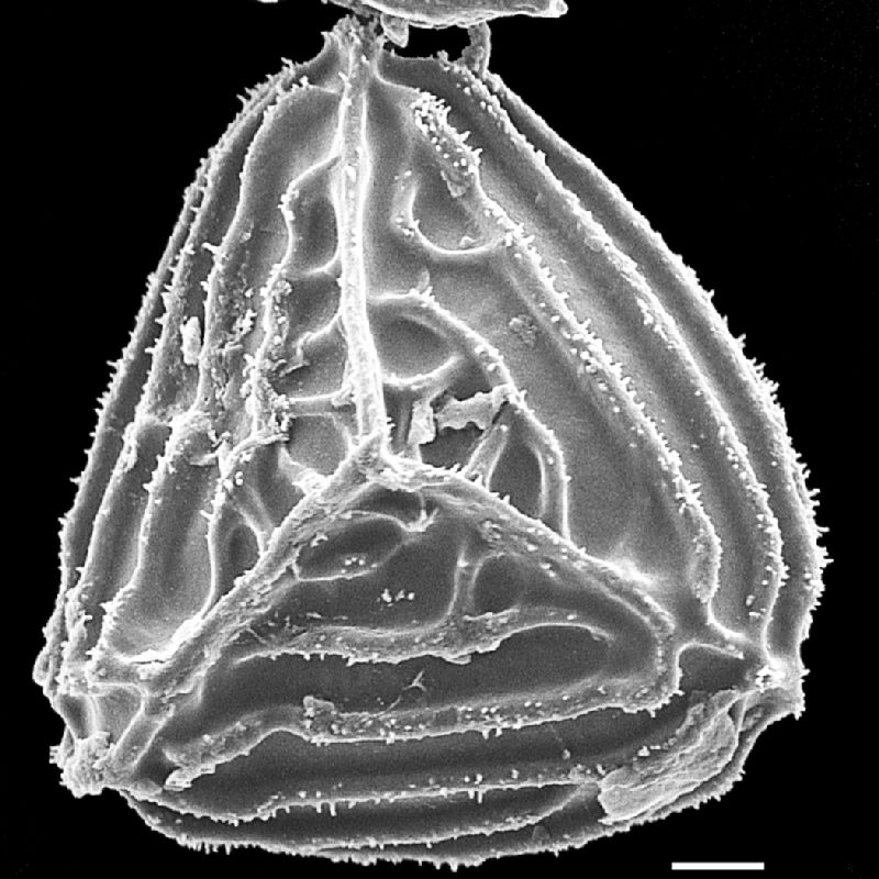 Anemiaceae Anemia familiaris