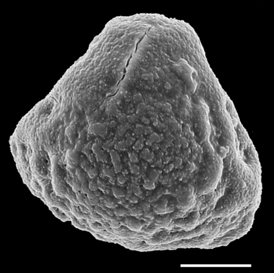 Dennstaedtiaceae Dennstaedtia bipinnata