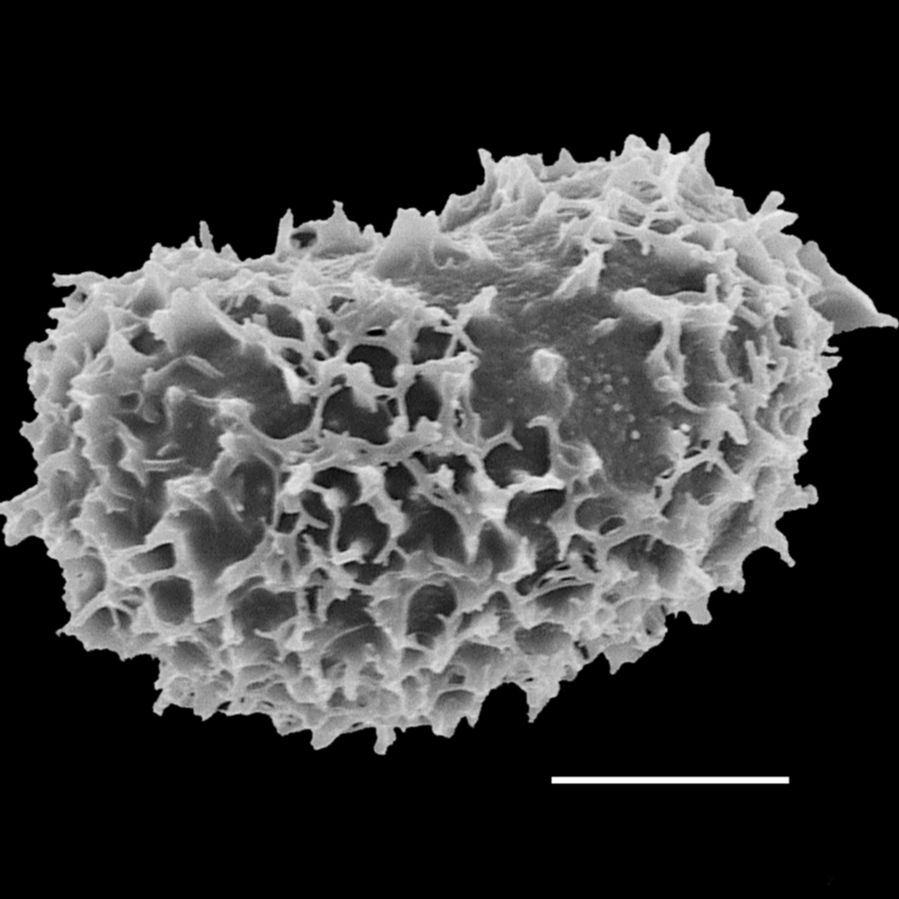 Dennstaedtiaceae Hypolepis bogotensis