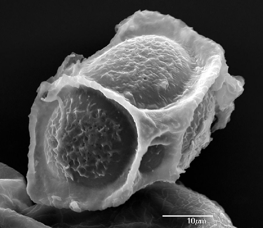 Dryopteridaceae Elaphoglossum angustius