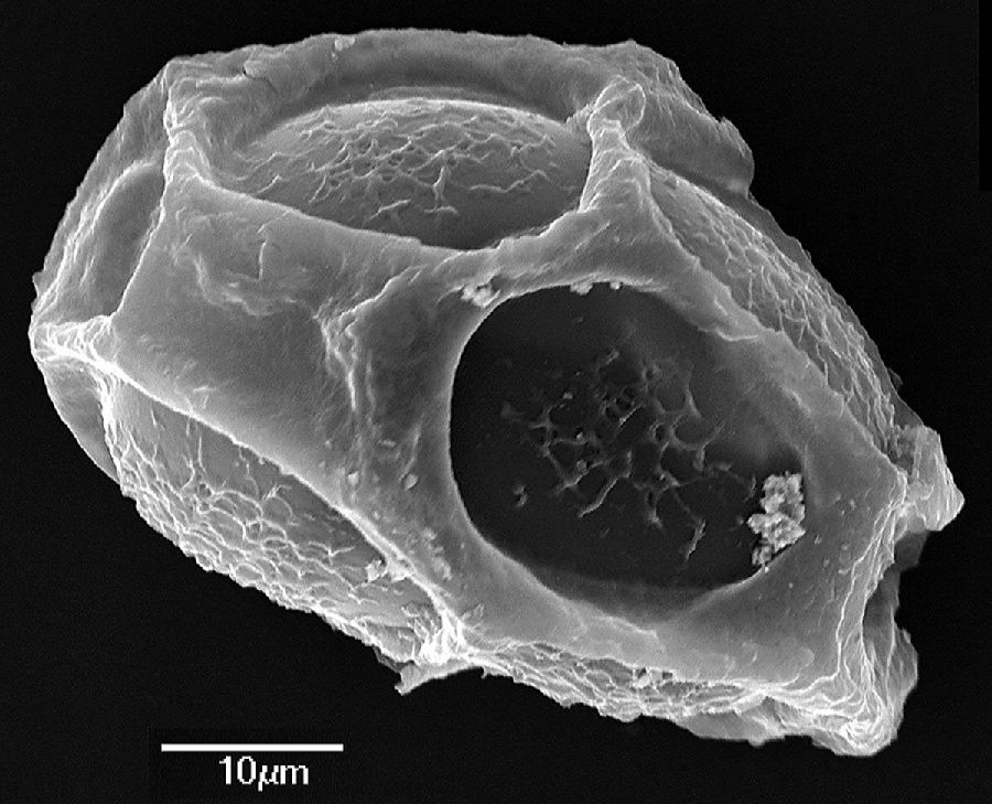 Dryopteridaceae Elaphoglossum angustius