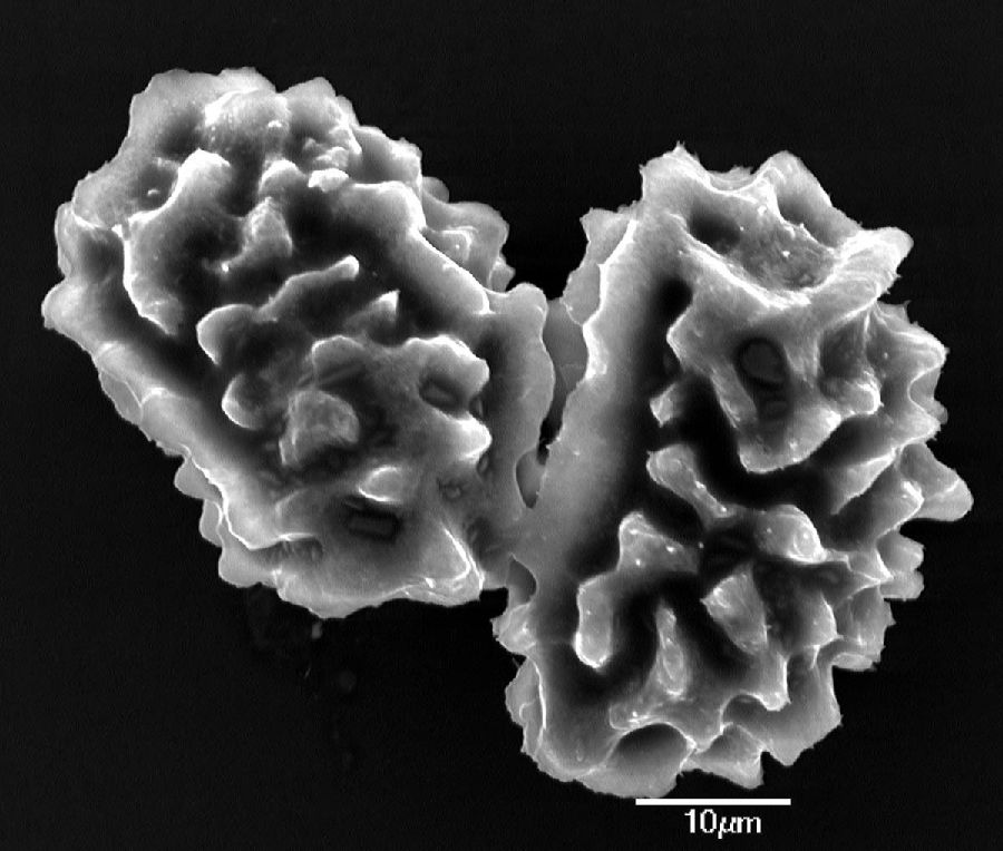 Dryopteridaceae Elaphoglossum antisanae