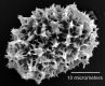 image of Elaphoglossum croatii